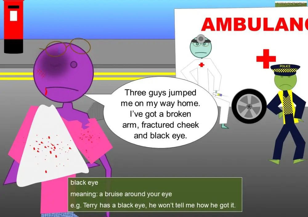 EYE idioms (body idioms) Mingleish